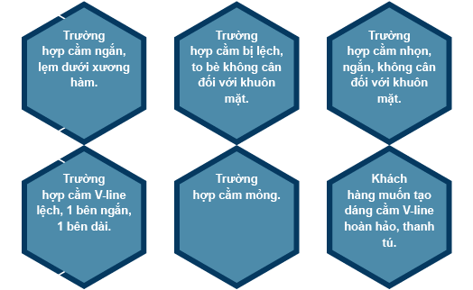 don cam vline 2