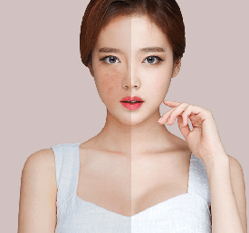 Cong nghe white laser